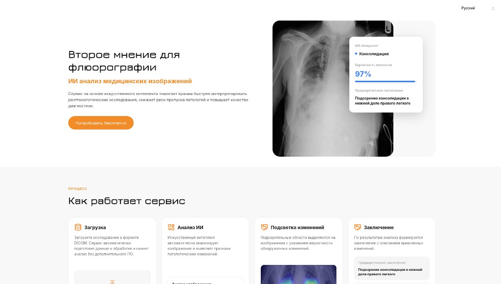 Второе мнение для флюорографии